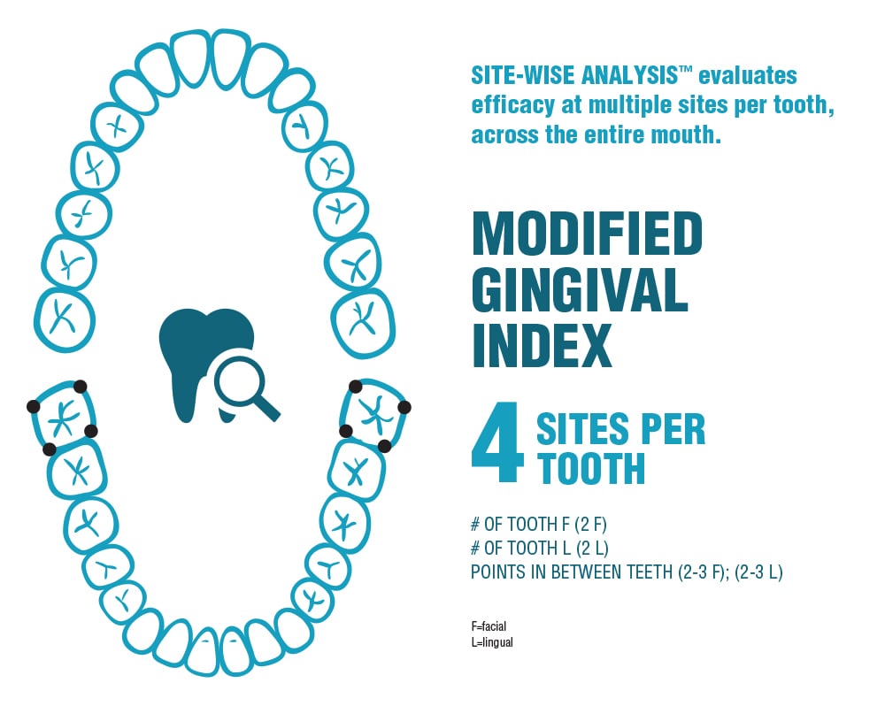 Infographic showing results of modified gingival index during SITE-WISE® ANALYSIS and use of LISTERINE® Antiseptic Mouthwash