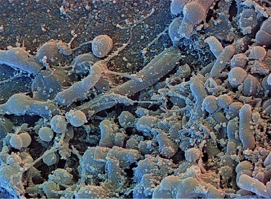 Then microbes form a complex biofilm in the mouth within days